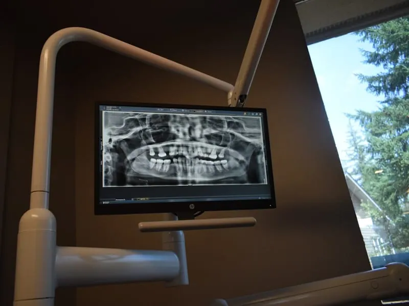 Panoramique dentaire 2D/3D CBCT — Owandy